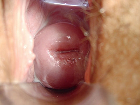 Szyjka macicy i śluz szyjkowy- cykl miesiączkowy